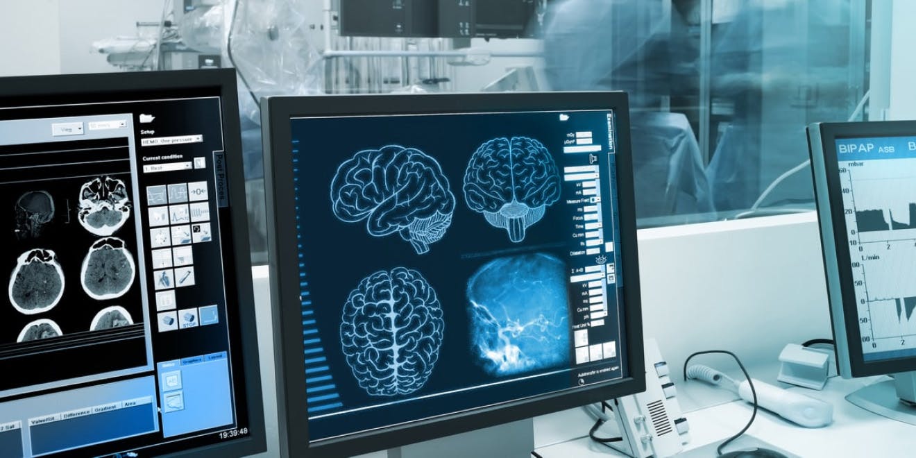 Adopting AI into healthcare software products 